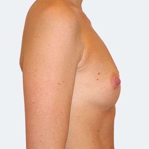 Image before
