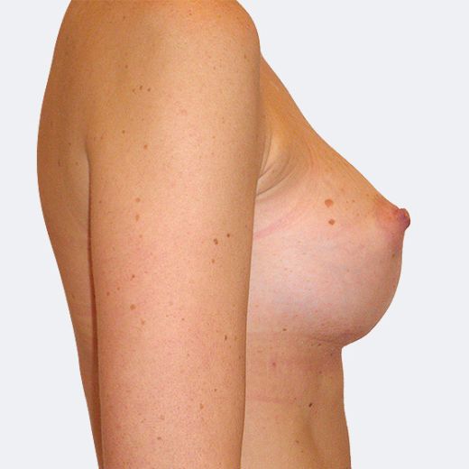 Image after