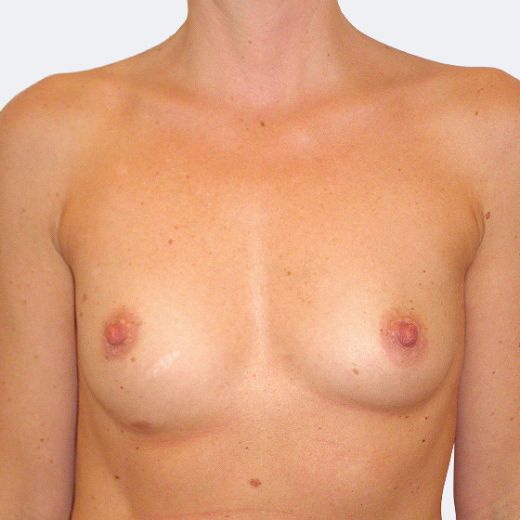 Image before