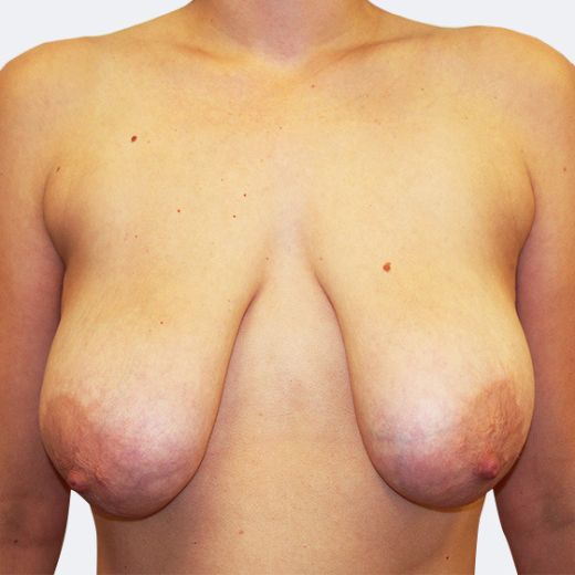 Image before