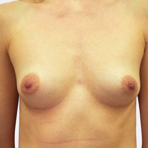 Image before