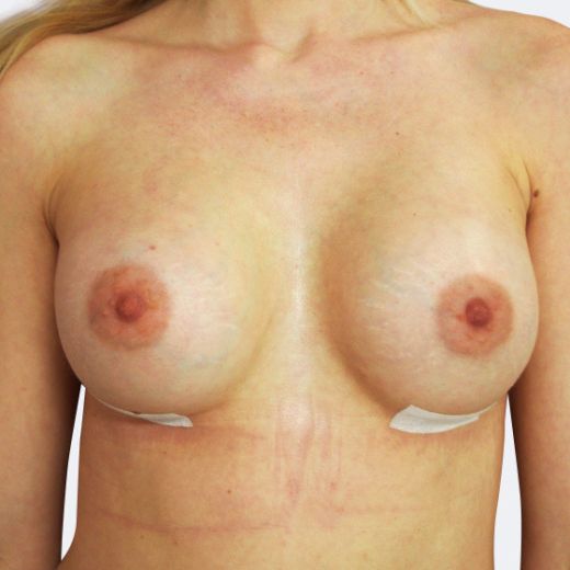 Image after