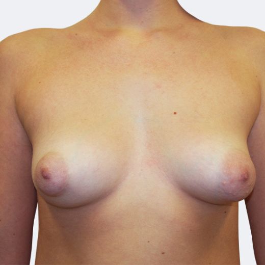 Image before