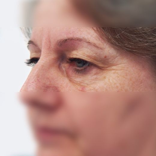 Image before