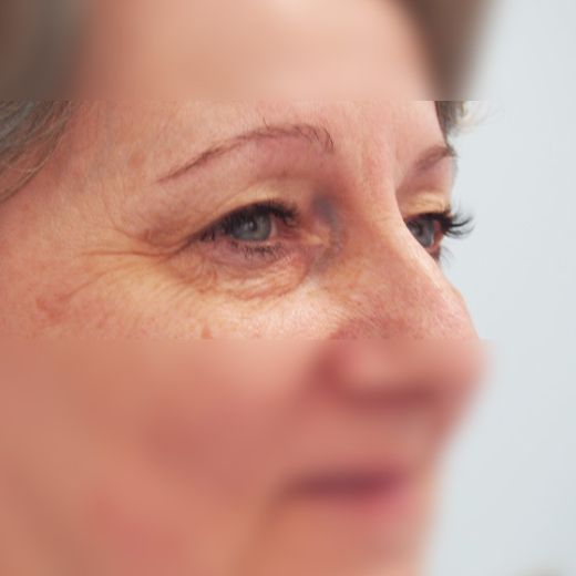 Image before