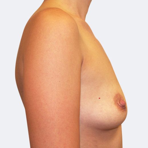 Image before