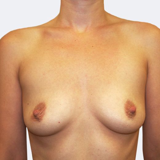 Image before