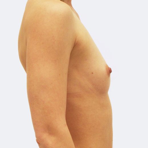Image before