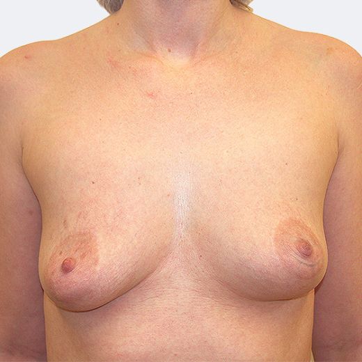 Image before
