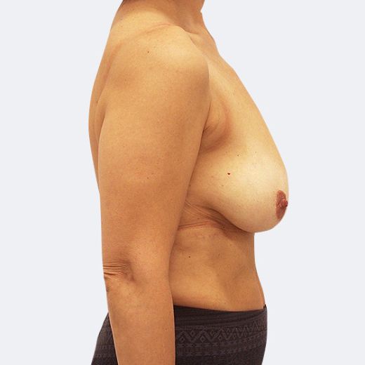 Image before