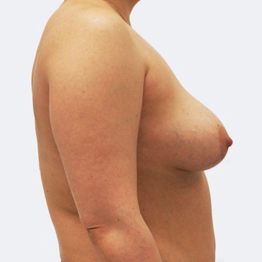Image before