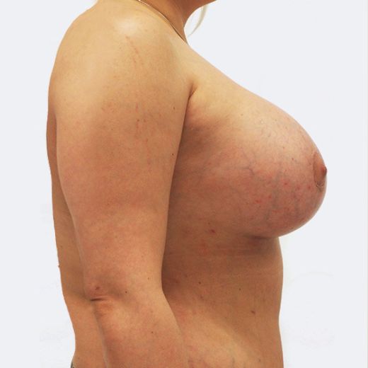 Image after