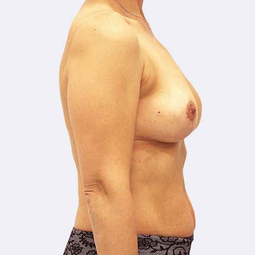 Image after