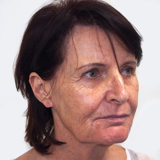 Image before