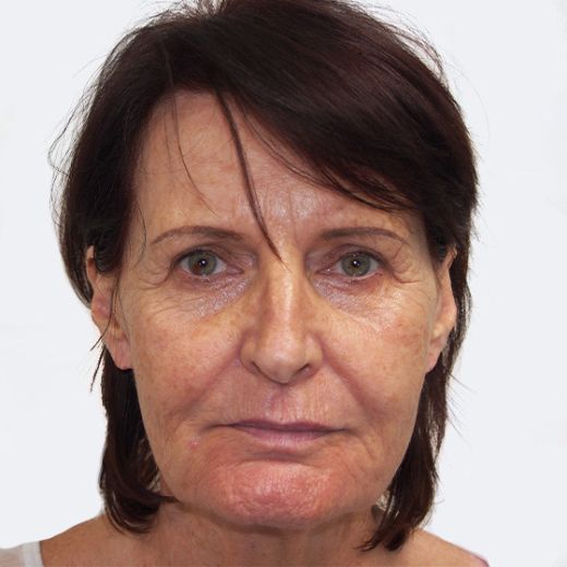 Image before