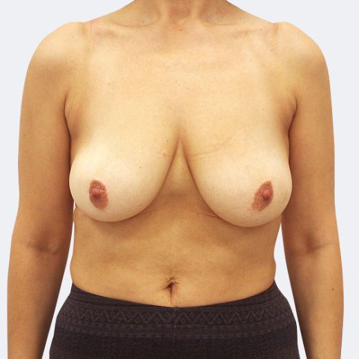 Image before
