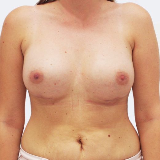 Image after