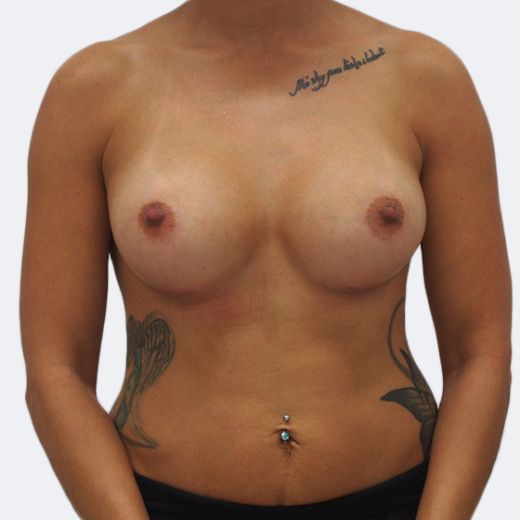 Image after