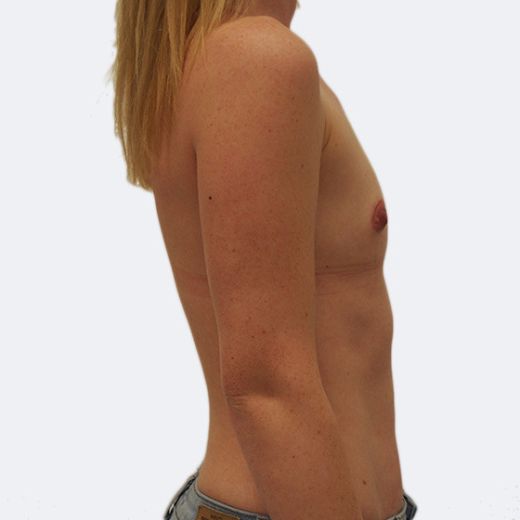Image before