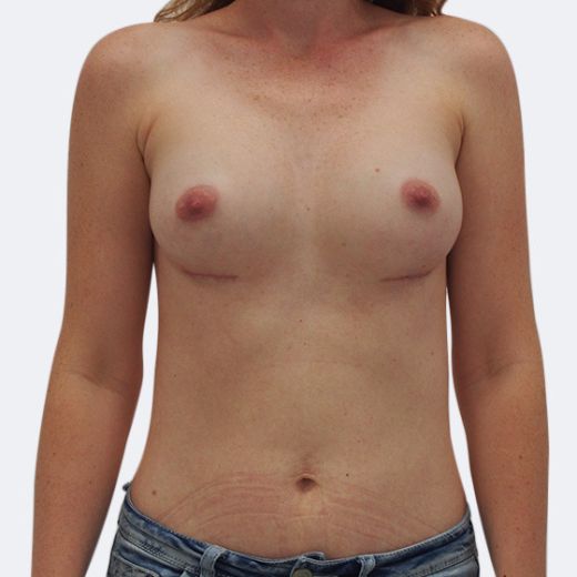 Image after