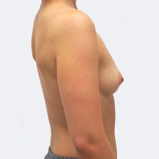 Image before