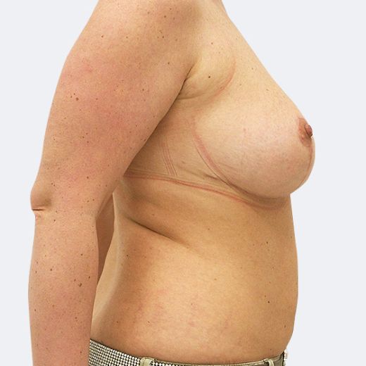 Image after