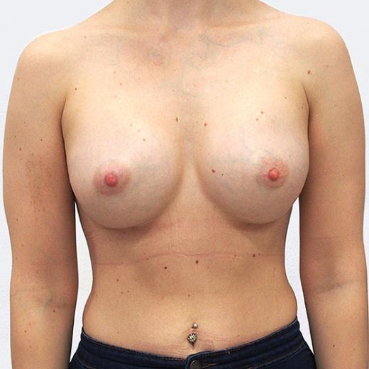 Image after