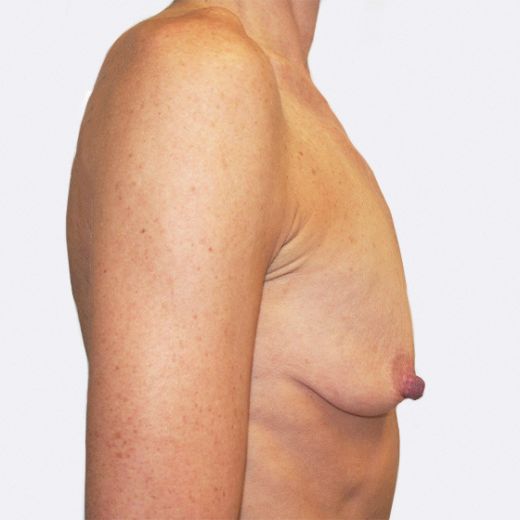 Image before