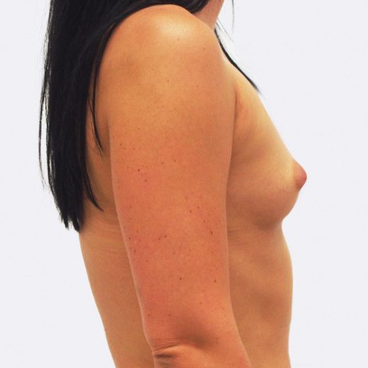 Image before