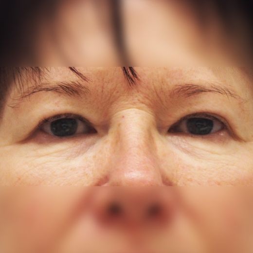 Image before