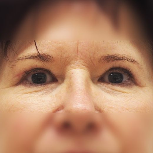 Image after