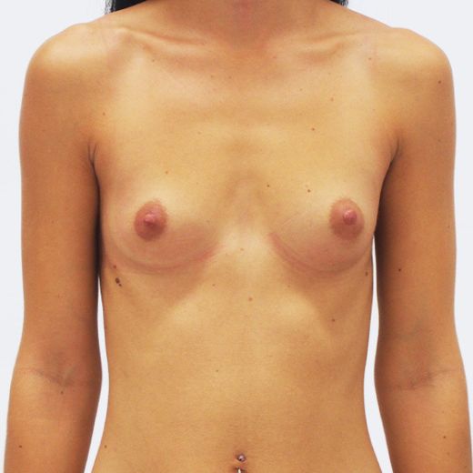 Image before