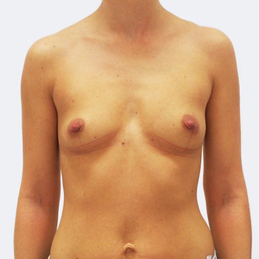 Image before
