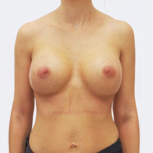 Image after