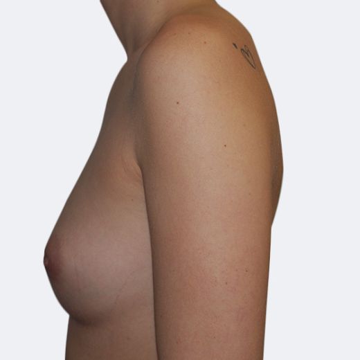 Image before