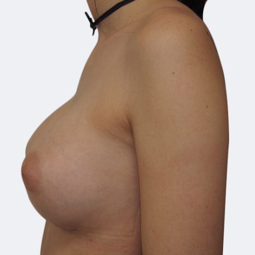 Image after