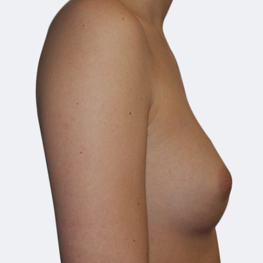 Image before