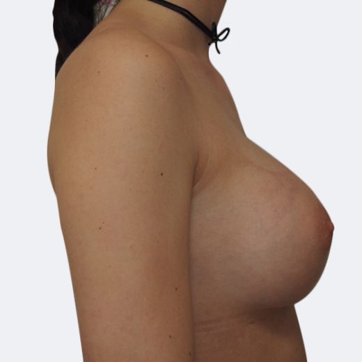 Image after