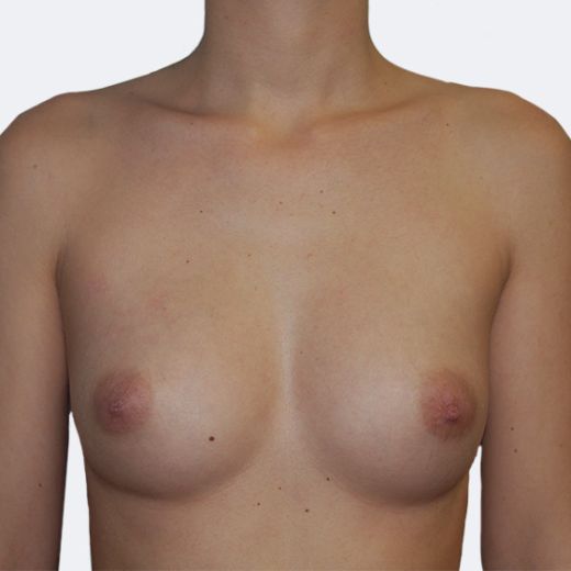 Image before