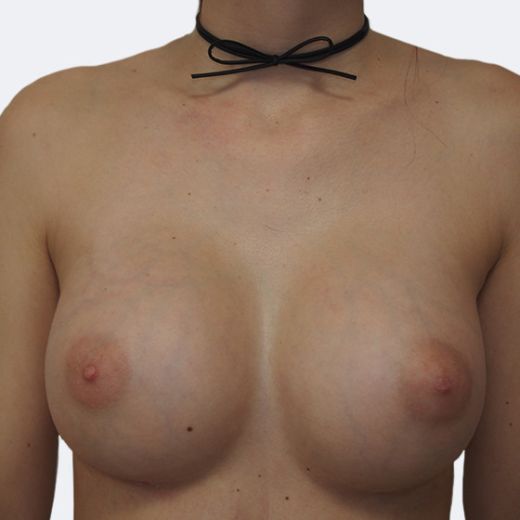 Image after