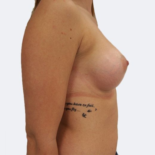 Image after