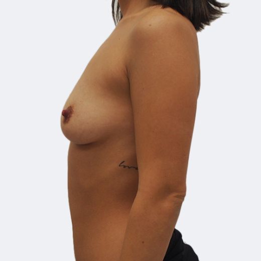 Image before