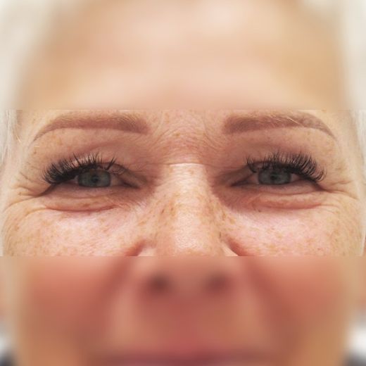 Image before