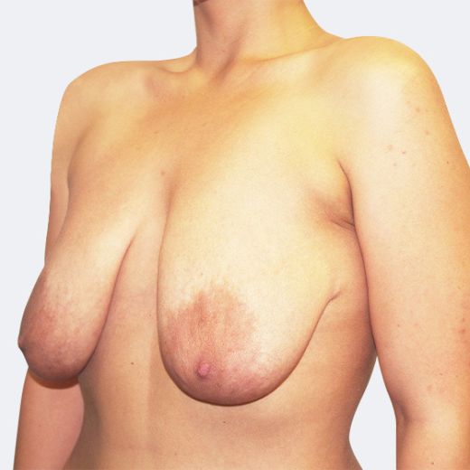 Image before