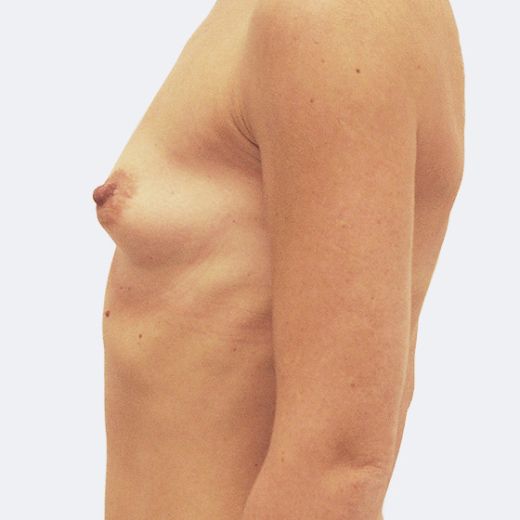 Image before