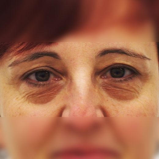 Image before