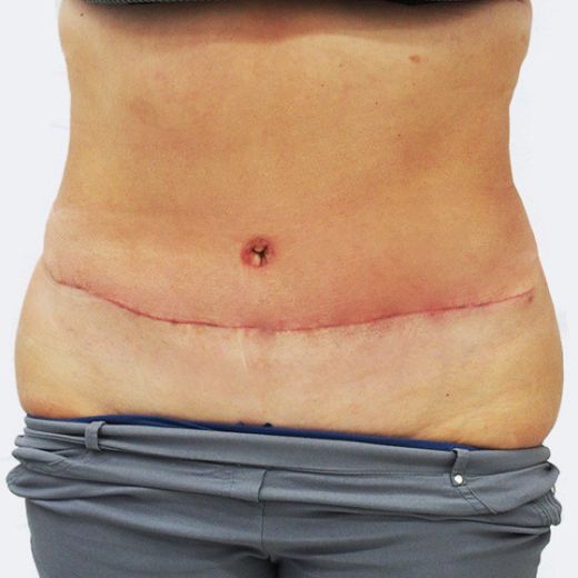 Image after