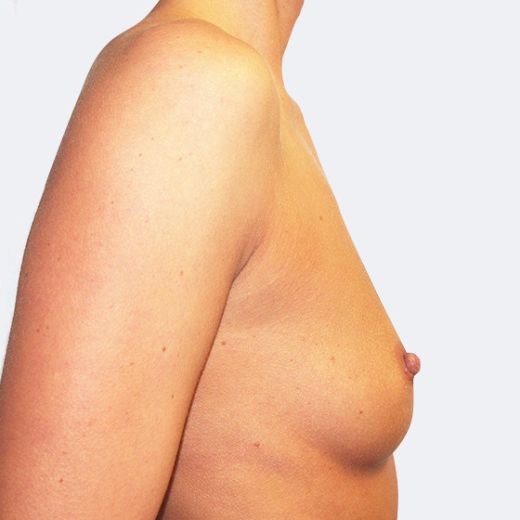 Image before