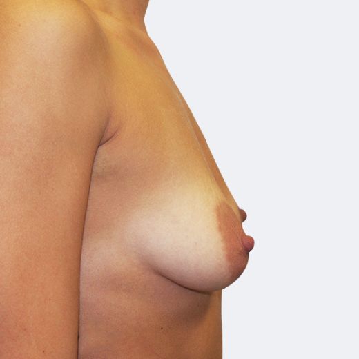 Image before