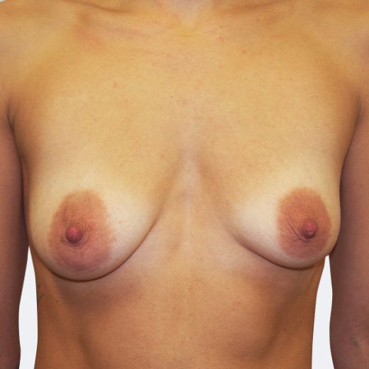 Image before